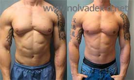 differences between arimidex and nolvadex